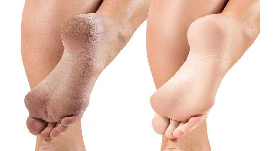 سوهان و رنده پا دو طرفه - Image 4