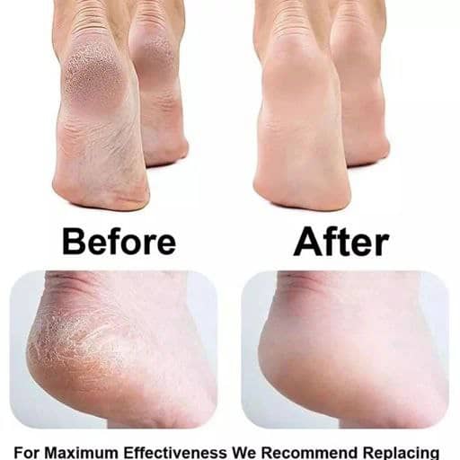 سوهان و رنده پا دو طرفه - Image 5