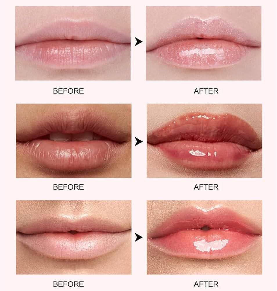 حجم دهنده لب آمپولی MISS LARA - Image 4