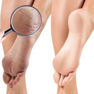 کرم ترک پا کیس بیوتی – Kiss Beauty Foot Care Cream - تصویر 5