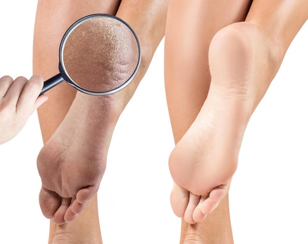 کرم ترک پا کیس بیوتی – Kiss Beauty Foot Care Cream - تصویر 5
